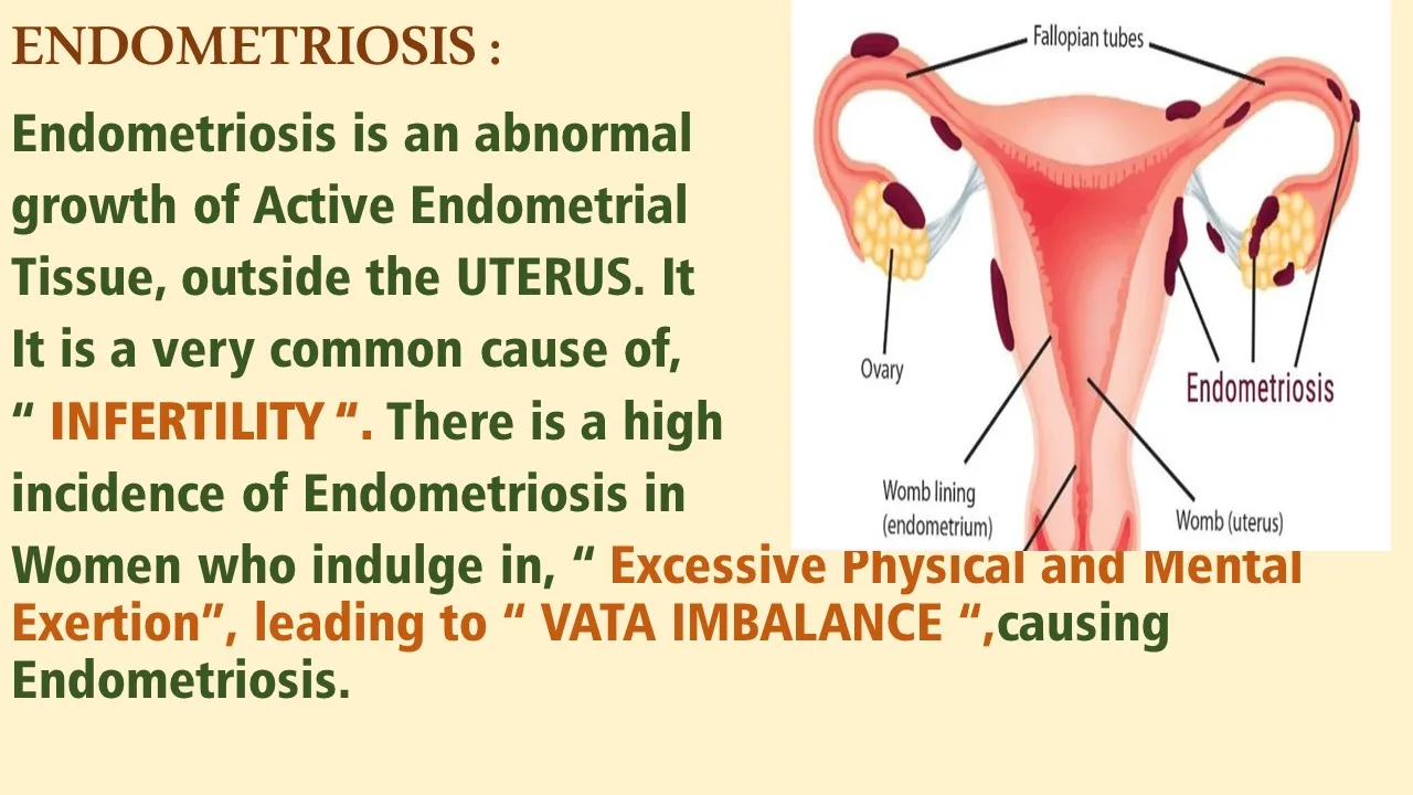 Endometriosis case — stage 2